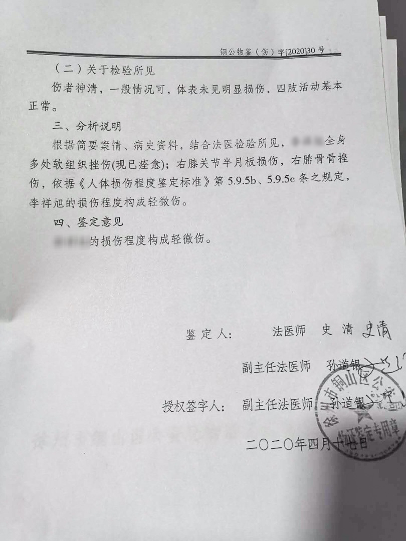 李小明在当地法医门诊做了伤情鉴定。据报告显示:李小明全身多处软组织挫伤(现已痊愈);右膝关节半月板损伤,右腓骨骨挫伤,鉴定为轻微伤。