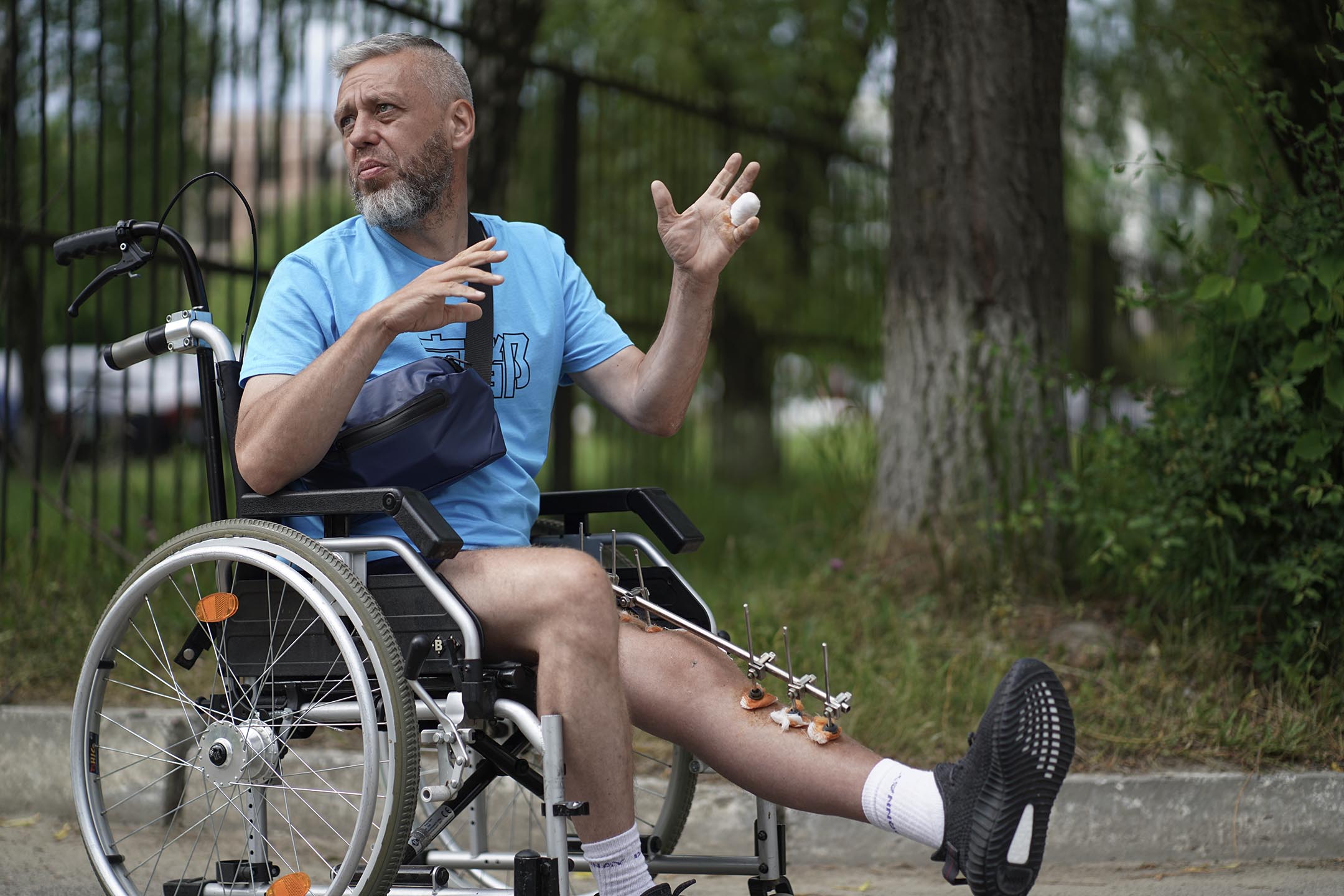 45歲軍人德米特羅(Dmytro),在4月8日時,在哈爾科夫省的一個村莊,遭到俄軍坦克攻擊,他的小隊,一人當場死亡,一人生還。他被撤離到利沃夫的軍事醫院療傷。